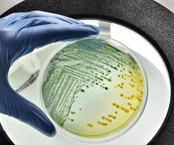 hodowla bakterii na płytce Petriego