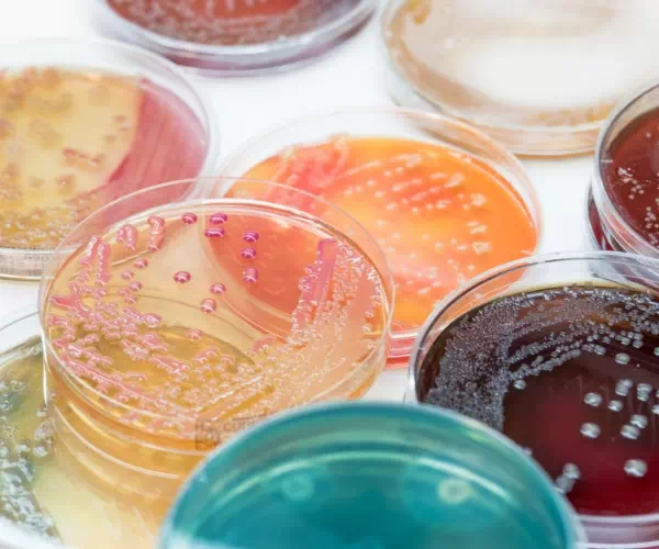 płytki Petriego z różnymi kulturami bakterii