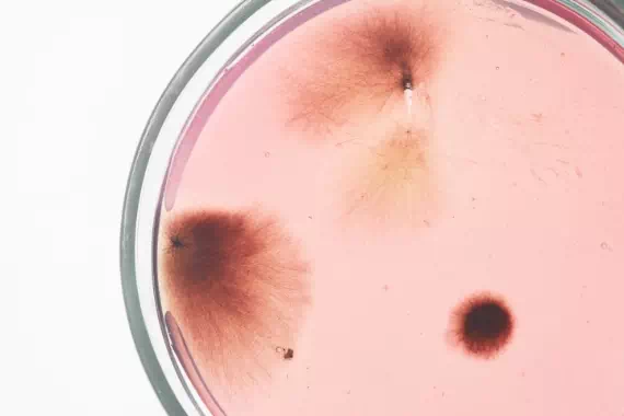 kultury bakterii na płytce Petriego